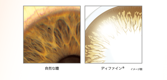 自然な瞳 ディファイン®