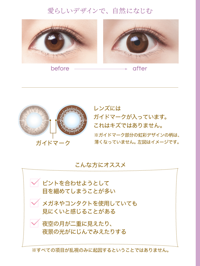 こんな方にオススメ　ピントを合わせようとして目を細めてしまうことが多い　メガネやコンタクトを使用していても見にくいと感じることがある　夜空の月が二重に見えたり、夜景の光がにじんでみえたりする
