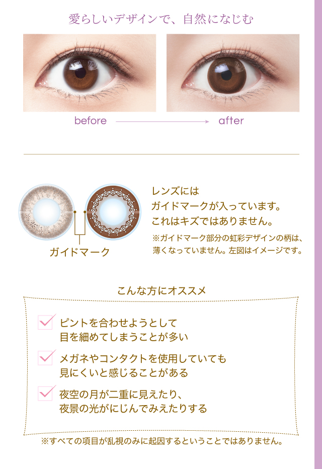 こんな方にオススメ　ピントを合わせようとして目を細めてしまうことが多い　メガネやコンタクトを使用していても見にくいと感じることがある　夜空の月が二重に見えたり、夜景の光がにじんでみえたりする