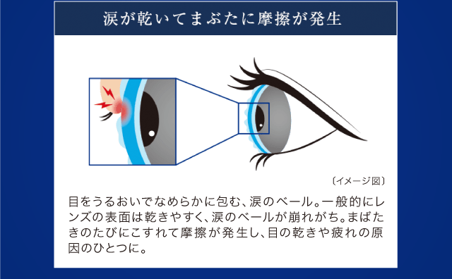 涙が乾いてまぶたに摩擦が発生〔イメージ図〕目をうるおいでなめらかに包む、涙のベール。一般的にレンズの表面は乾きやすく、涙のベールが崩れがち。まばたきのたびにこすれて摩擦が発生し、目の乾きや疲れの原因のひとつに。